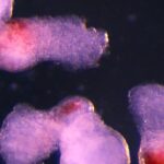 Cellule del sangue