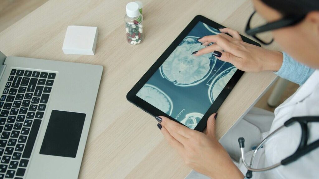 Ictus previsto con l'intelligenza artificiale