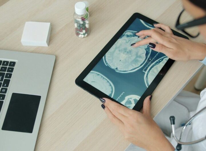Ictus previsto con l'intelligenza artificiale