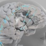 Il cervello