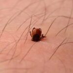 zecca sulla pelle