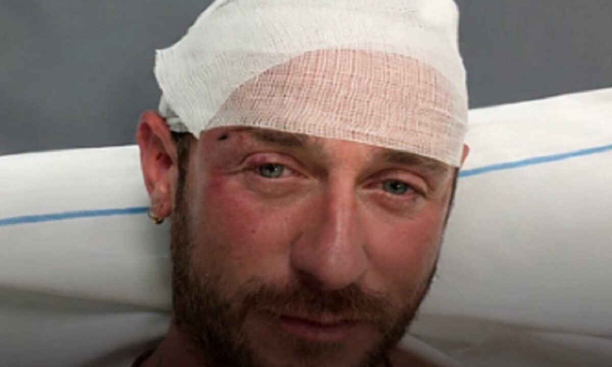 Angelo Ratti con la testa fasciata