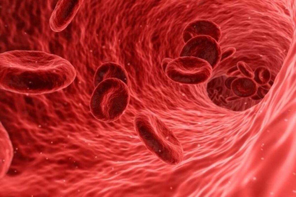 placche di colesterolo nel sangue