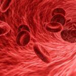 placche di colesterolo nel sangue