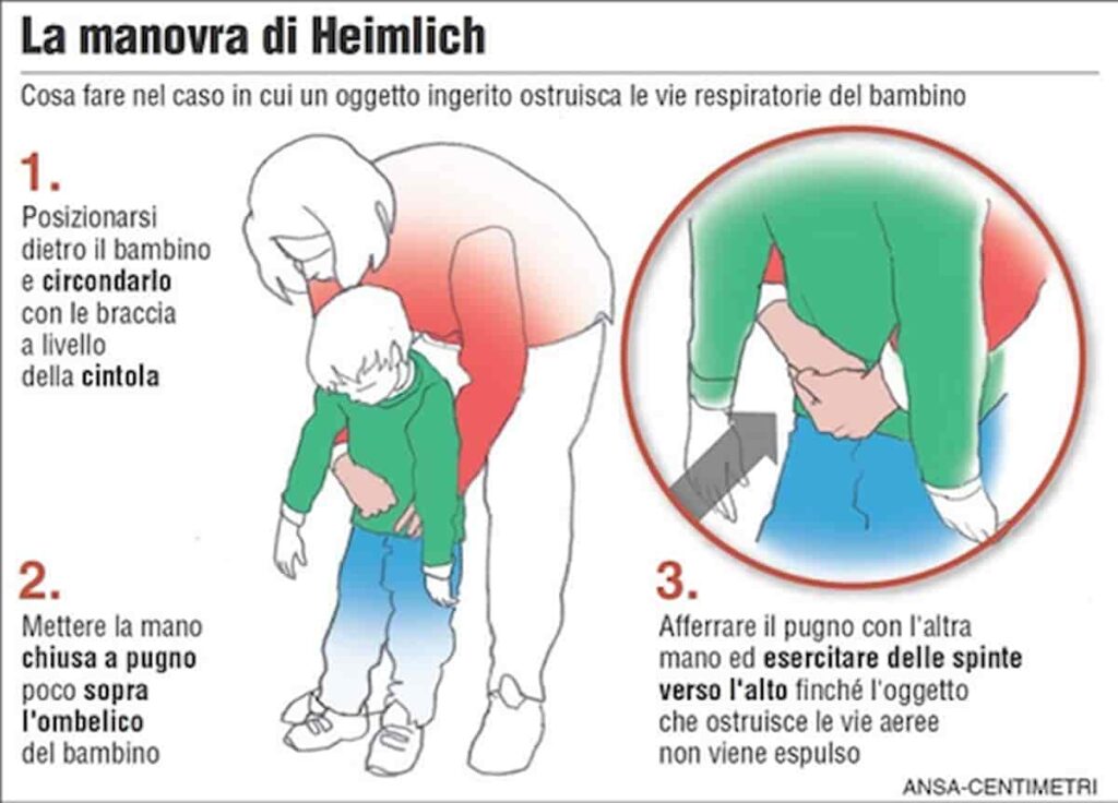 manovra di heimlich