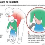 manovra di heimlich