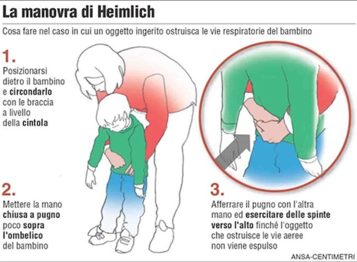 manovra di heimlich