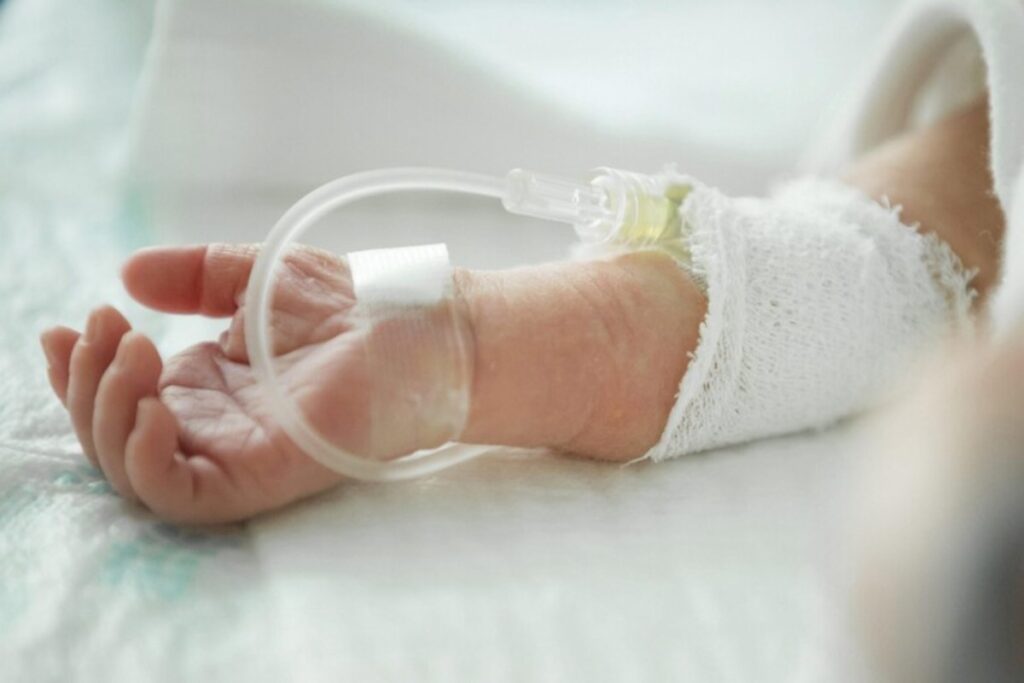 neonato ricoverato