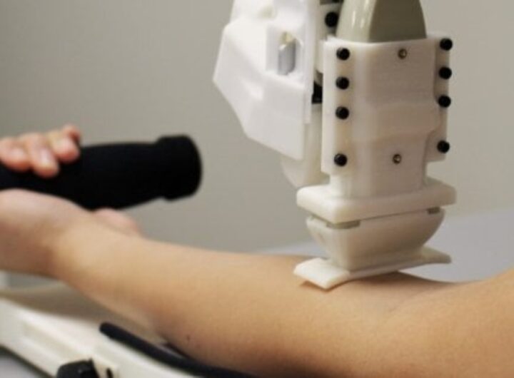 robot prelievi sangue