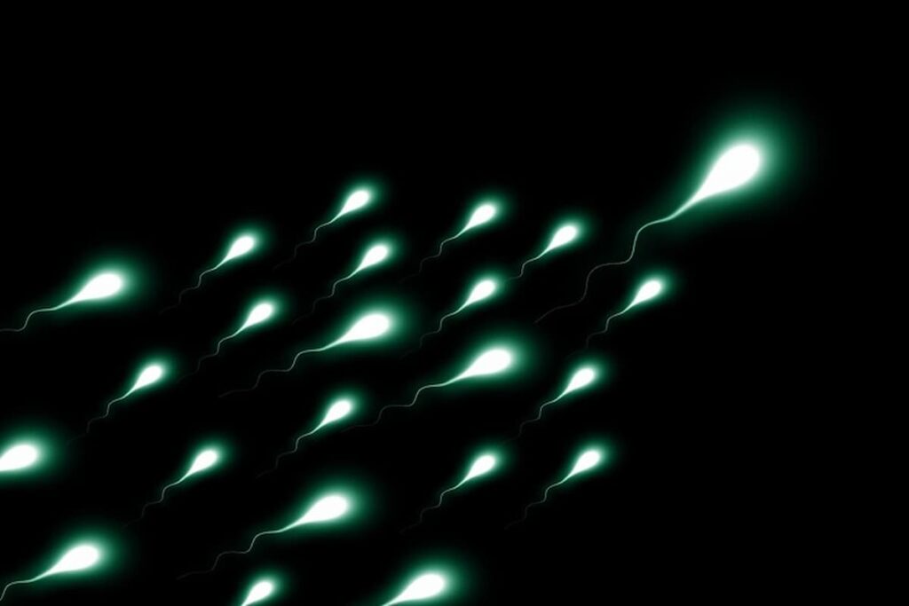 spermatozoi