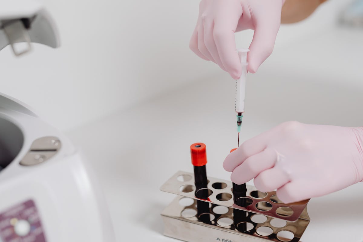 analisi del sangue