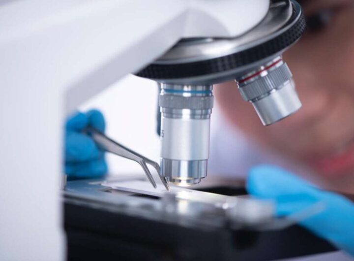 microscopio