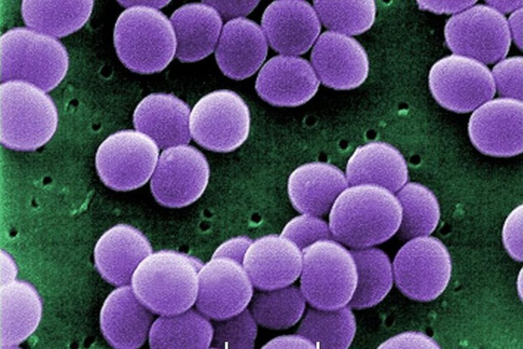 Aspergillus