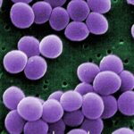 Aspergillus