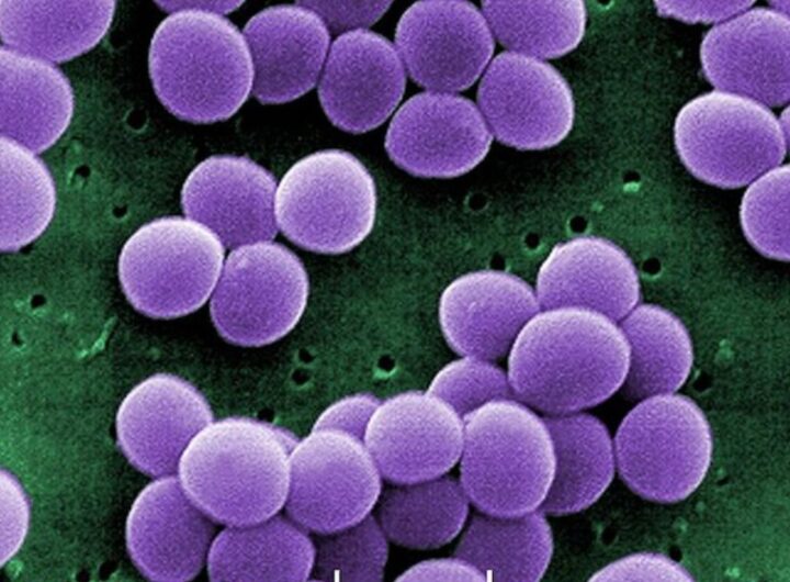 Aspergillus