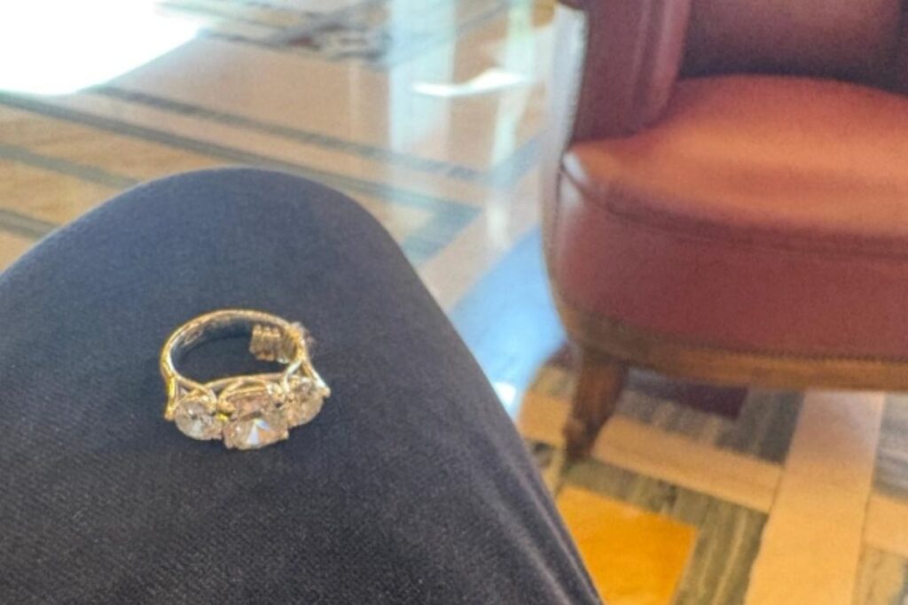 anello matone