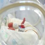 neonato prematuro