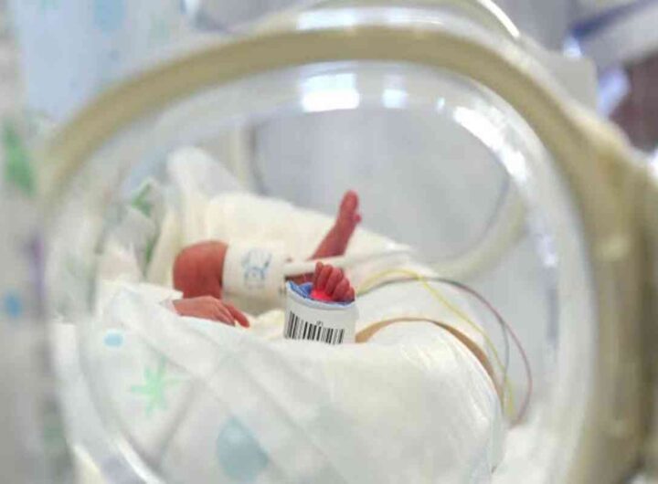 neonato prematuro