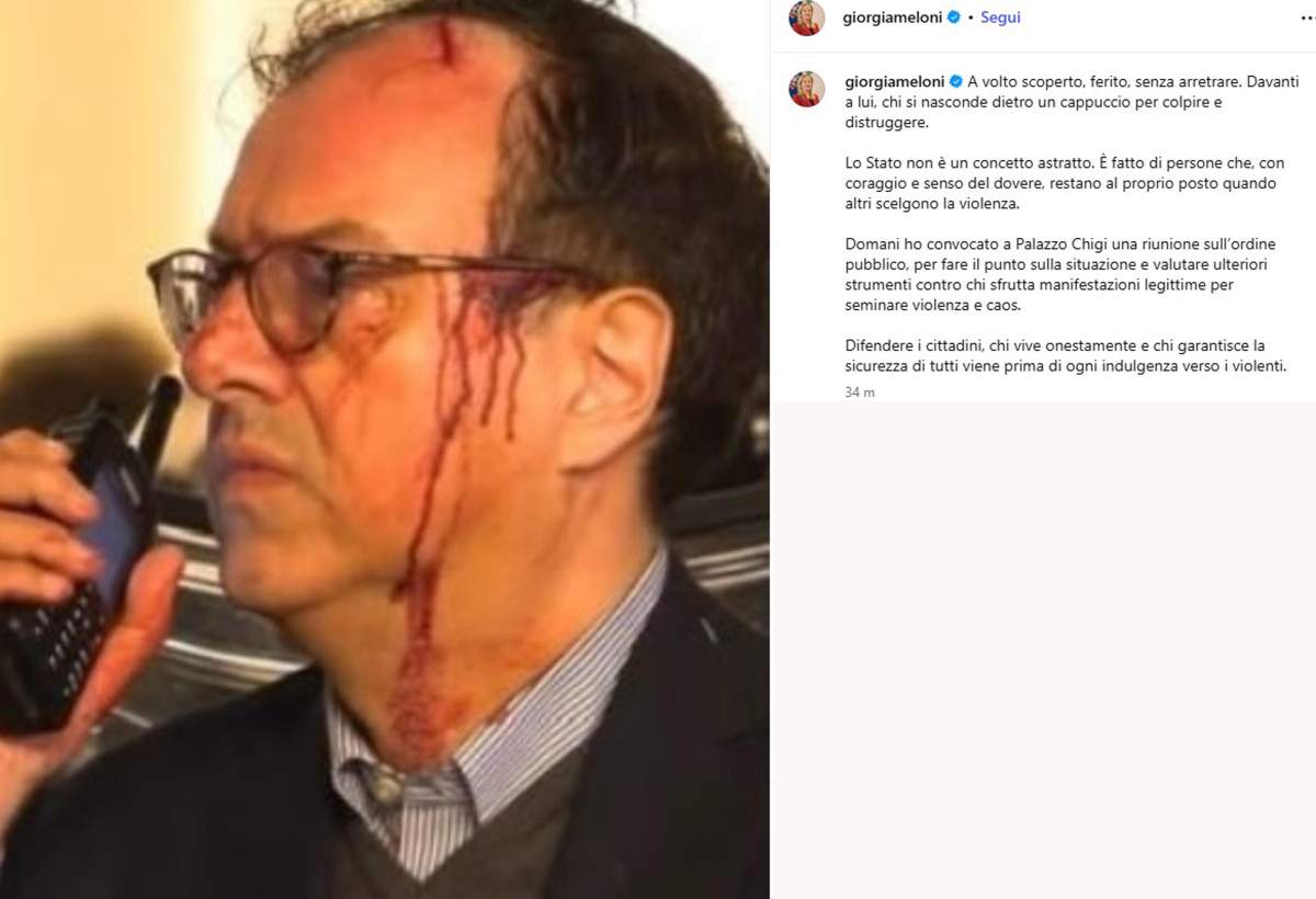 La foto dell'agente ferito a Milano pubblicata da Meloni (Ansa)