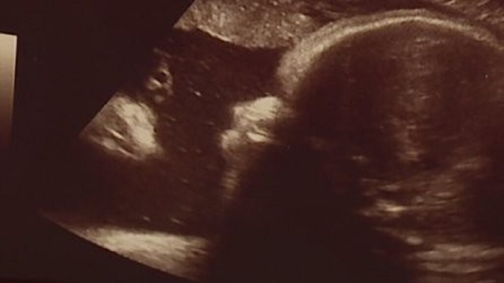 Il volto di Gesù appare nella radiografia di un feto