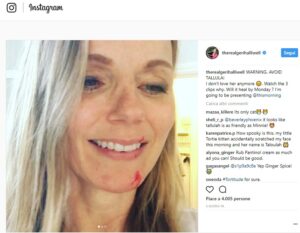 Geri Halliwell graffiata dalla gatta di casa: il VIDEO Instagram dell'ex Spice Girls