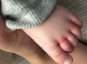 neonato dita piede