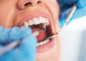 Pulizia denti: prima il filo e poi lo spazzolino, così si rimuova più placca