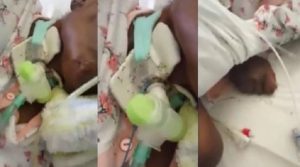 Napoli, paziente intubata ricoperta di formiche. La donna che ha postato il video: "Scena orribile"