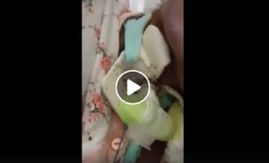 Napoli: paziente in ospedale intubata e totalmente sommersa dalle formiche VIDEO