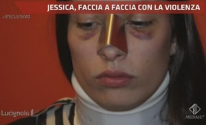 Lucignolo: Jessica, la ragazza picchiata dall'ex 