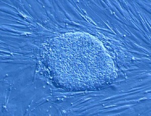 Staminali, nucleo antiproiettile in trasformazione da embrione a cellula adulta