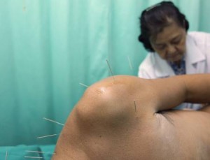 Agopuntura, omeopatia, shiatsu e fitoterapia: te le paga la Sanità