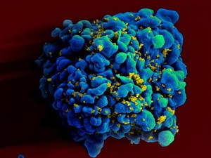 Hiv, bimba Mississipi ancora malata: terapia contro Aids tutta da rifare