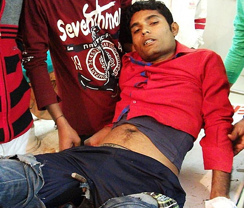 India: si ubriaca, scivola e viene trafitto da una barra di metallo nell'ano FOTO