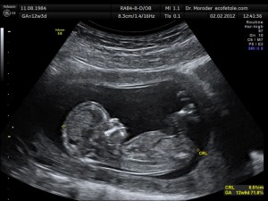 Abortisce perché è un maschio: "Non voglio dare la vita a un mostro"