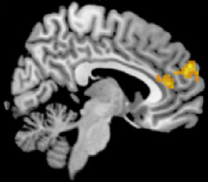 Cervello, "piano B" nasce nella corteccia prefrontale: ecco dove cambi strategia