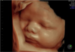 Video YouTube, ecografia 4D per vedere il feto in movimento