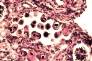 Gravidanza: citomegalovirus, scoperto come prevenirlo: provoca cecità e ritardi
