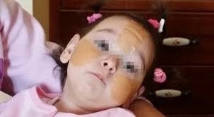 Vittoria De Biase, bimba malata: azienda Usa nega il farmaco