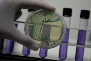 Usa, laboratori perdono batteri della peste: è allarme