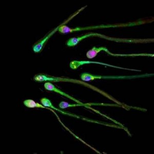 Spermatozoi da tessuto uomo sterile: prima volta al mondo
