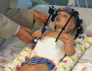 Testa riattaccata a bimbo 16 mesi: l'operazione miracolo