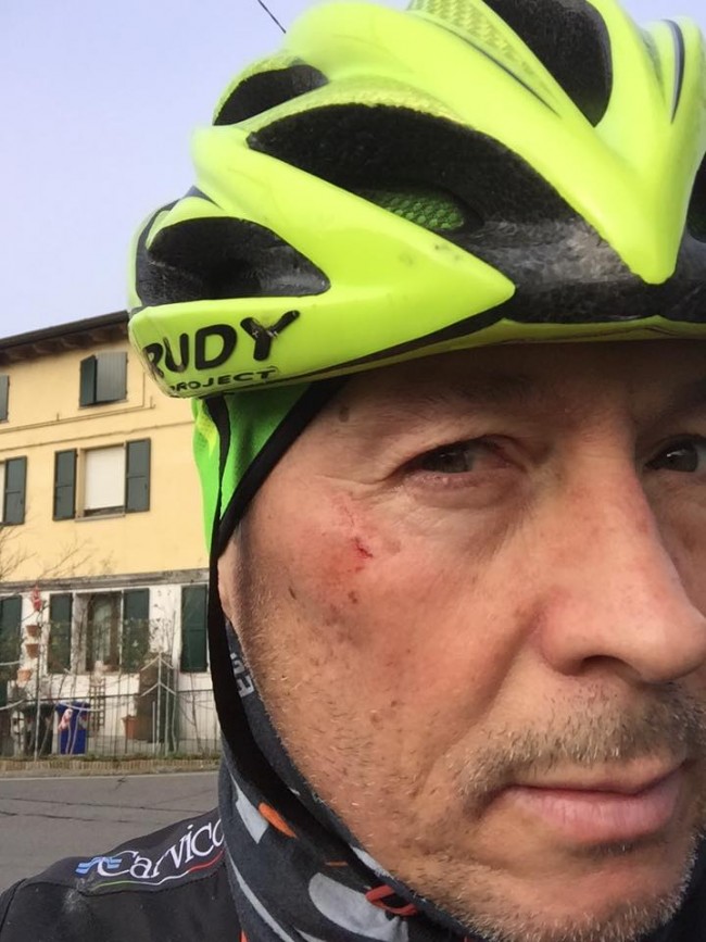 Paolo Belli ferito in bici da auto pirata a Carpi FOTO