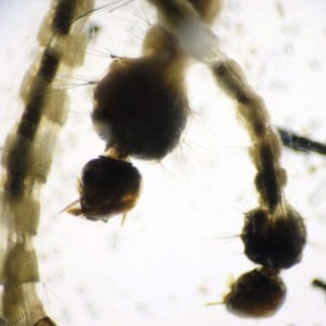 Virus Zika: primo caso per via venerea anche in Francia