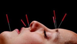 Agopuntura, cosa cura? Sì contro dolori, no per sigarette...