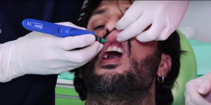 YOUTUBE Fabrizio Corona, spot per una clinica dentistica