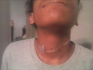 Bullismo: presa al laccio al collo FOTO, genitori denunciano scuola3