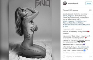 Anastacia si spoglia sul web Mostro le cicatrici per non dimenticare FOTO