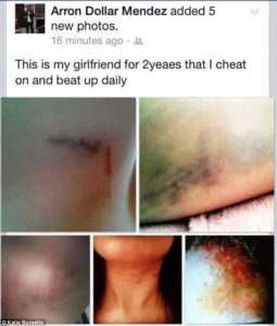 Picchiava la compagna e si vantava delle ferite inflitte su Facebook FOTO choc