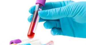  Cancro, test sangue dice quanto resta da vivere ai malati terminali